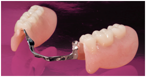 partial dentures